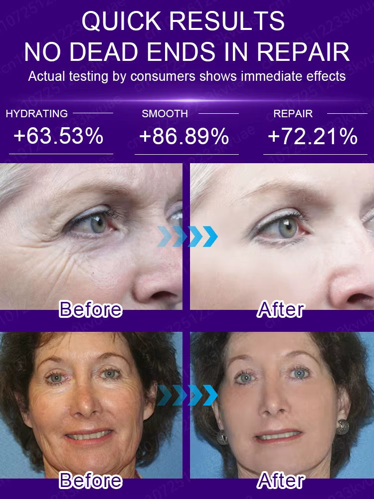 No Wrinkles - Look 20 years younger!