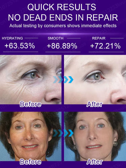 No Wrinkles - Look 20 years younger!