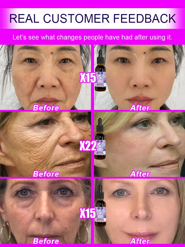No Wrinkles - Look 20 years younger!