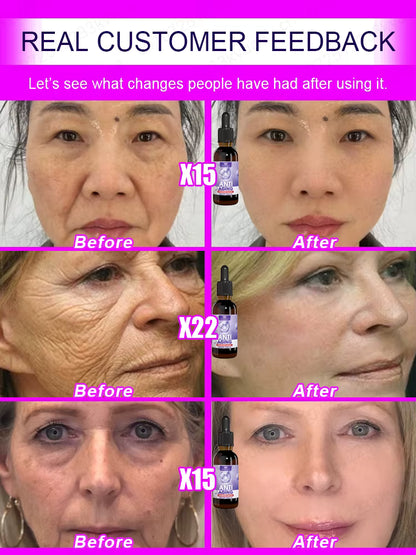 No Wrinkles - Look 20 years younger!