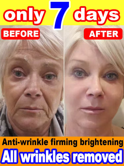 No Wrinkles - Look 20 years younger!